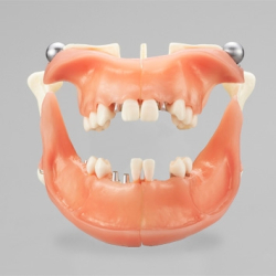 Implantat Studiemodel 